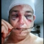 Tragedia en Brasil: habla la mamá de la joven atropellada.